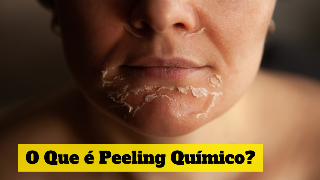 O-que-é-peeling-químico?
