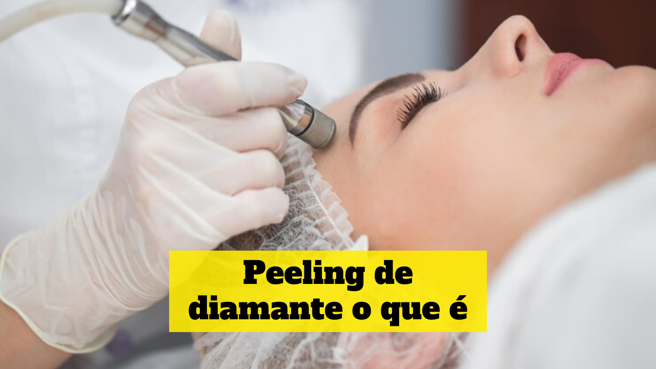 peeling de diamante o que é