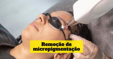 remoção de micropigmentação