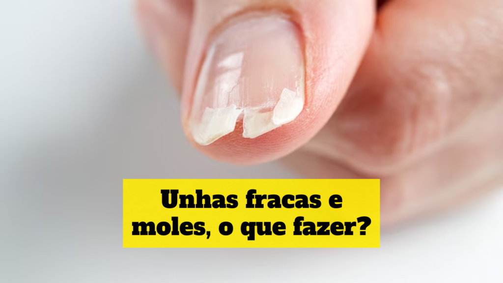 unhas fracas e moles o que fazer