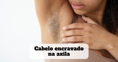 cabelo encravado na axila